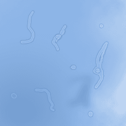 Simulation of eye floaters appearing against a bright blue sky